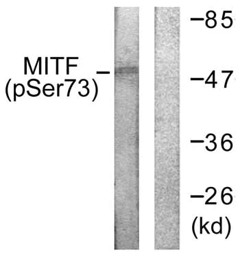 Western blot - Anti-MiTF (phospho S73) antibody (AB59201)