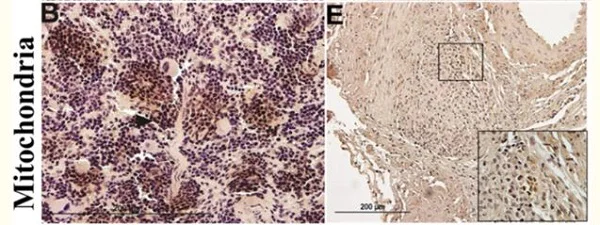 Immunohistochemistry (Formalin/PFA-fixed paraffin-embedded sections) - Anti-Mitochondria antibody [113-1] - BSA and Azide free (AB92824)