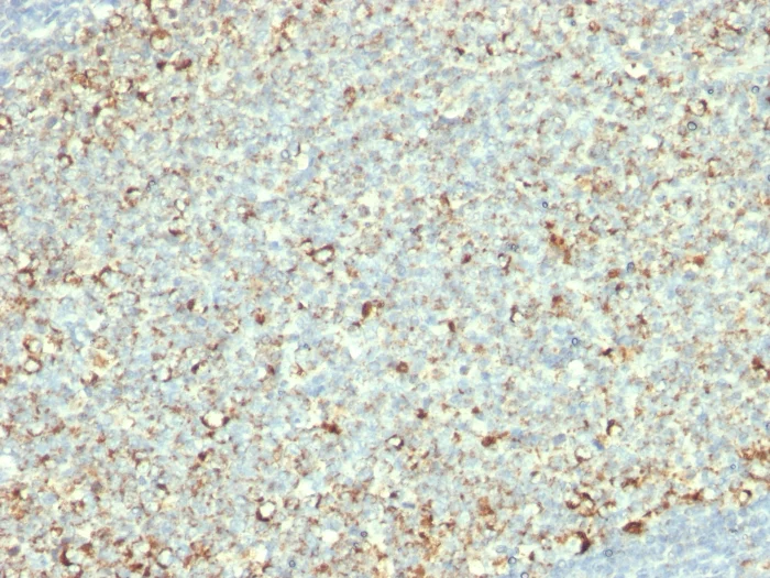 Immunohistochemistry (Formalin/PFA-fixed paraffin-embedded sections) - Anti-Mitochondria antibody [AE-1] (AB215892)