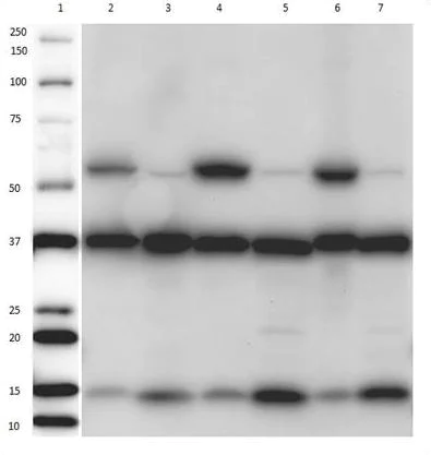 Western blot - Mitochondria Fraction Western Blot Cocktail (AB139416)
