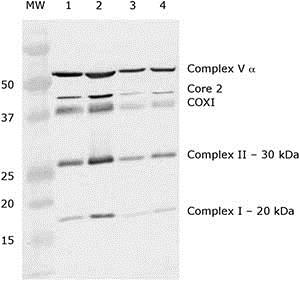 Western blot - Mitochondria Isolation Kit for Tissue (AB110168), expandable thumbnail