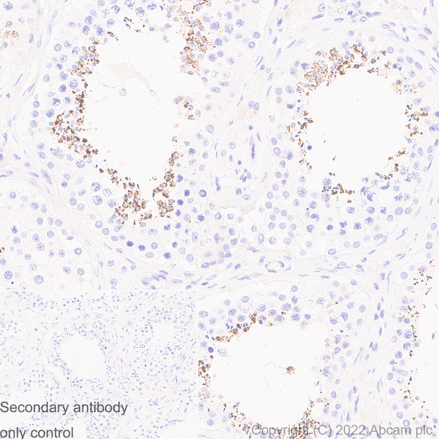 Immunohistochemistry (Formalin/PFA-fixed paraffin-embedded sections) - Anti-Mitochondrial Ferritin antibody [EPR1797] (AB124889)