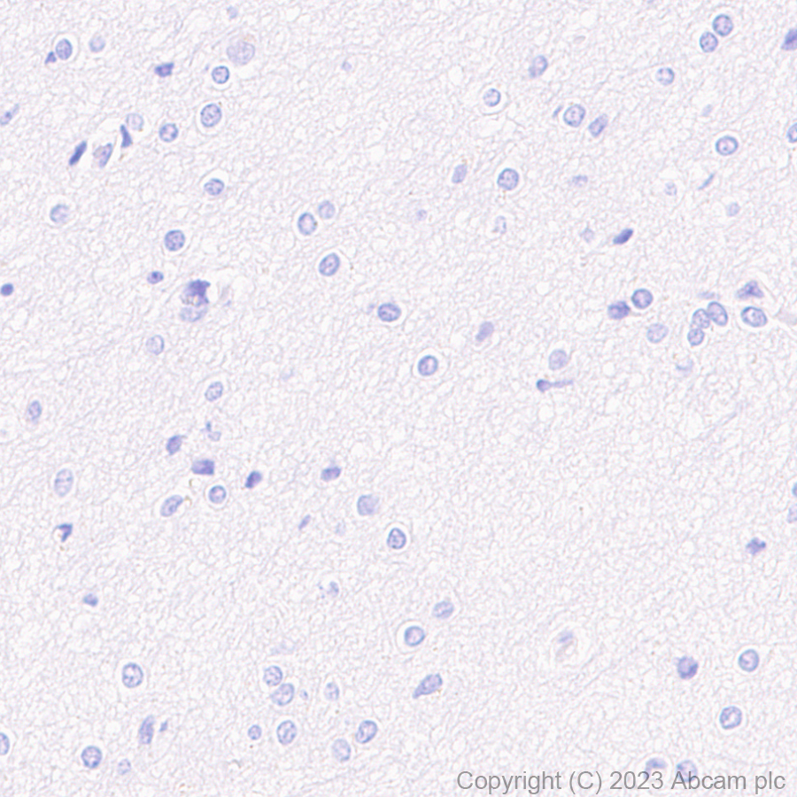 Immunohistochemistry (Formalin/PFA-fixed paraffin-embedded sections) - Anti-Mitochondrial Ferritin antibody [EPR1797] (AB124889)