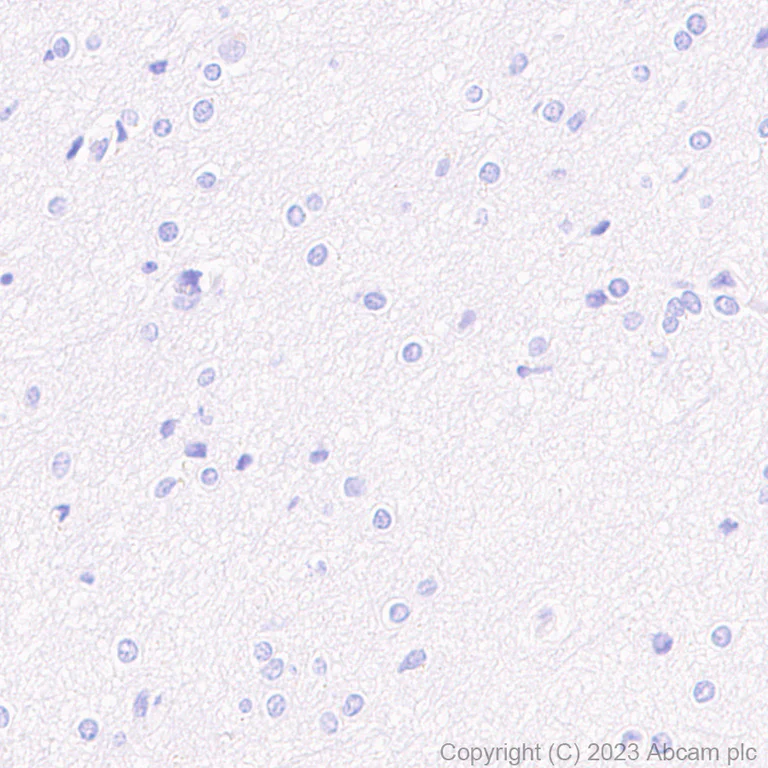 Immunohistochemistry (Formalin/PFA-fixed paraffin-embedded sections) - Anti-Mitochondrial Ferritin antibody [EPR1797] (AB124889)