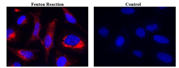 Fluorescence Microscopy - Mitochondrial Hydroxyl Radical Detection Assay Kit (AB219931), expandable thumbnail