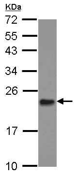 Western blot - Anti-Mitochondrial ribosomal protein L11 antibody (AB127034)