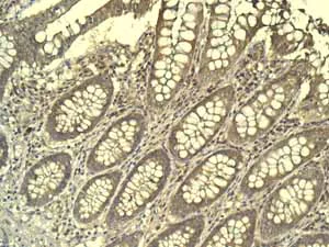 Immunohistochemistry (Formalin/PFA-fixed paraffin-embedded sections) - Anti-Mitochondrial ribosomal protein L11 antibody [EPR9111(B)] (AB133789)