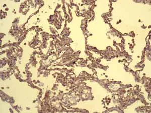 Immunohistochemistry (Formalin/PFA-fixed paraffin-embedded sections) - Anti-Mitochondrial ribosomal protein L11 antibody [EPR9111(B)] (AB133789)
