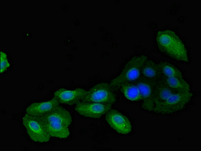 Immunocytochemistry/ Immunofluorescence - Anti-Mitofilin antibody (AB229653), expandable thumbnail