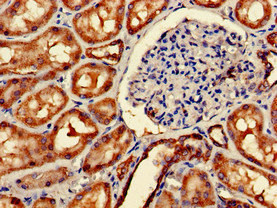 Immunohistochemistry (Formalin/PFA-fixed paraffin-embedded sections) - Anti-Mitofilin antibody (AB229653), expandable thumbnail