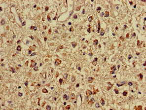 Immunohistochemistry (Formalin/PFA-fixed paraffin-embedded sections) - Anti-Mitofilin antibody (AB229653), expandable thumbnail
