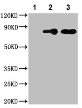 Immunoprecipitation - Anti-Mitofilin antibody (AB229653), expandable thumbnail
