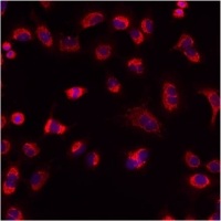 Immunocytochemistry/ Immunofluorescence - Anti-Mitofilin antibody (AB93323)