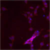Immunocytochemistry/ Immunofluorescence - Anti-Mitofilin antibody (AB93323)
