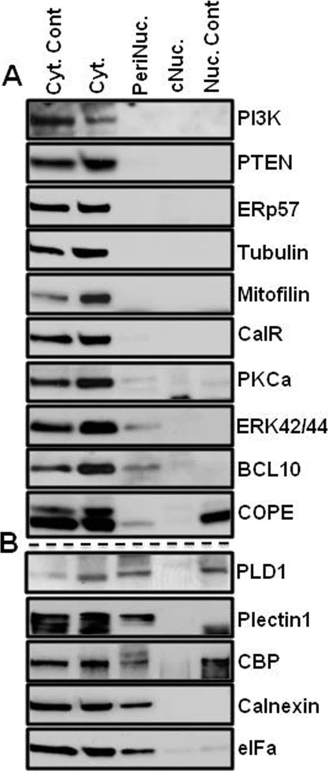 Western blot - Anti-Mitofilin antibody [EPR8749] (AB137057)