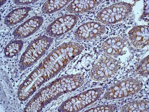 Immunohistochemistry (Formalin/PFA-fixed paraffin-embedded sections) - Anti-Mitofilin antibody [EPR8749] - BSA and Azide free (AB245764)