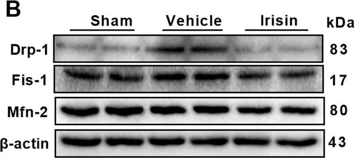 Western blot - Anti-Mitofusin 2 antibody [NIAR164] (AB124773)