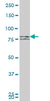 Western blot - Anti-Mitofusin 2 + Mitofusin 1 antibody [3C9] (AB57602), expandable thumbnail