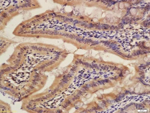 Immunohistochemistry (Formalin/PFA-fixed paraffin-embedded sections) - Anti-MitoNEET antibody (AB203096)