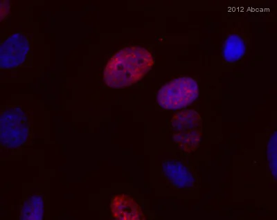 Immunocytochemistry - Anti-Mitotic proteins antibody [MPM-2] (AB14581)