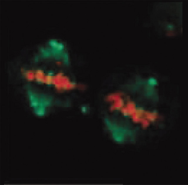 Immunocytochemistry - Anti-Mitotic proteins antibody [MPM-2] (AB14581)