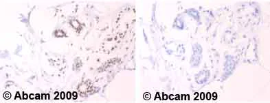 Immunohistochemistry (Formalin/PFA-fixed paraffin-embedded sections) - Anti-Mitotic proteins antibody [MPM-2] (AB14581)
