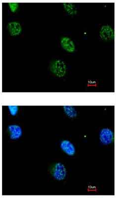 Immunocytochemistry/ Immunofluorescence - Anti-MK-3 antibody (AB155178)