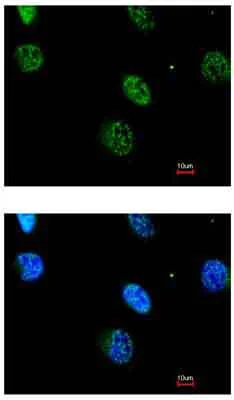 Immunocytochemistry/ Immunofluorescence - Anti-MK-3 antibody (AB155178)