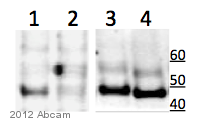 Western blot - Anti-MK2 antibody [E341] (AB32567), expandable thumbnail
