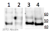 Western blot - Anti-MK2 antibody [E341] (AB32567)