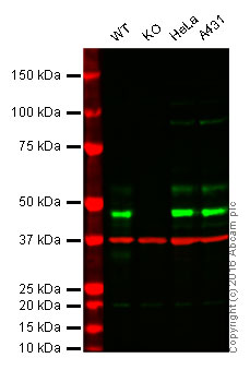 Western blot - Anti-MK2 antibody [EPR5357] (AB133279)