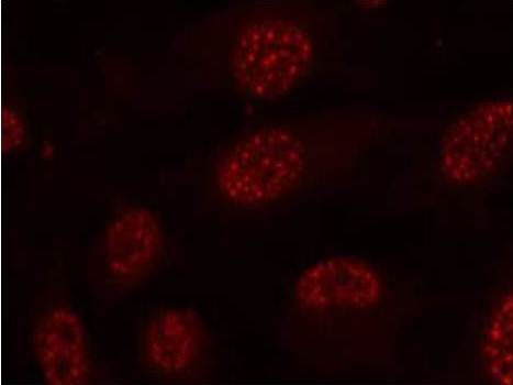 Immunocytochemistry/ Immunofluorescence - Anti-MK2 (phospho T334) antibody (AB131504), expandable thumbnail