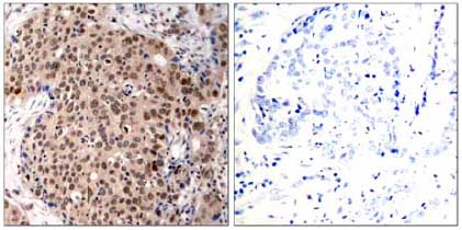 Immunohistochemistry (Formalin/PFA-fixed paraffin-embedded sections) - Anti-MK2 (phospho T334) antibody (AB131504), expandable thumbnail