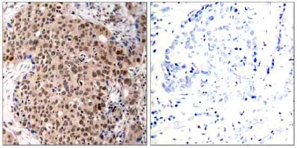 Immunohistochemistry (Formalin/PFA-fixed paraffin-embedded sections) - Anti-MK2 (phospho T334) antibody (AB131504)