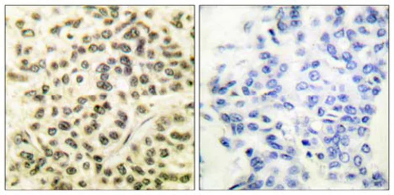 Immunohistochemistry (Formalin/PFA-fixed paraffin-embedded sections) - Anti-MK2 (phospho T334) antibody (AB63378)