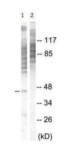 Western blot - Anti-MK2 (phospho T334) antibody (AB63378)