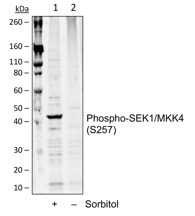 Western blot - Anti-MKK4 (phospho S257) antibody [SEK1MKK4S257-C5] (AB278619)