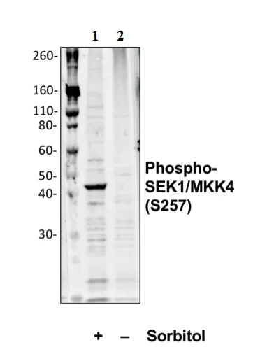 Western blot - Anti-MKK4 (phospho S257) antibody [SEK1MKK4S257-C5] (AB278619)