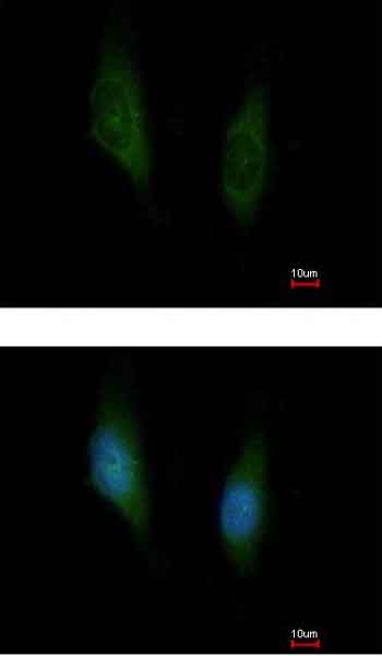 Immunocytochemistry/ Immunofluorescence - Anti-MKK6 antibody (AB154901)