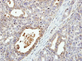 Immunohistochemistry (Formalin/PFA-fixed paraffin-embedded sections) - Anti-MKK6 antibody (AB154901)
