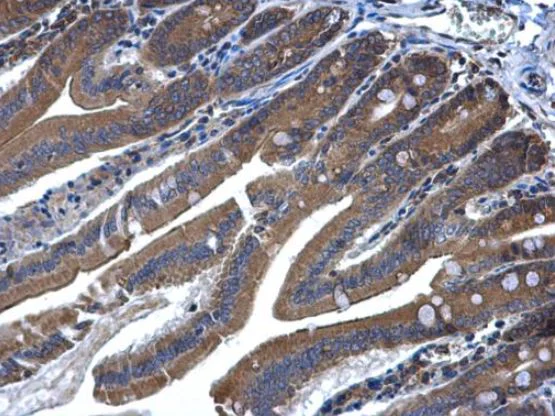 Immunohistochemistry (Formalin/PFA-fixed paraffin-embedded sections) - Anti-MKK6 antibody (AB154901)