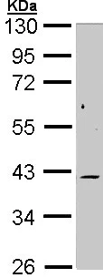 Western blot - Anti-MKK6 antibody (AB154901)