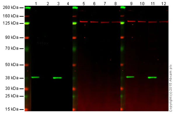 Western blot - Anti-MKK6 antibody [EP557Y] (AB33866)