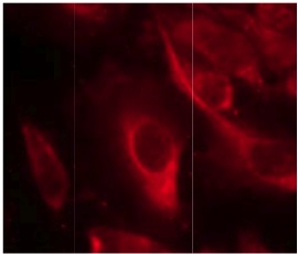 Immunocytochemistry/ Immunofluorescence - Anti-MKK6 (phospho S207) antibody (AB131257)