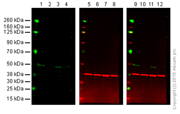 Western blot - Anti-MKK7 antibody [EP1455Y] (AB52618), expandable thumbnail