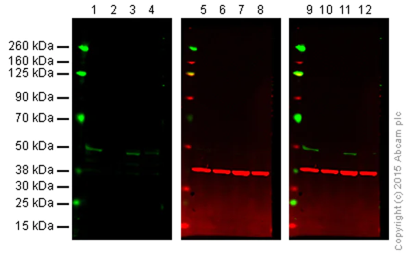 Western blot - Anti-MKK7 antibody [EP1455Y] (AB52618)