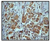 Immunohistochemistry (Formalin/PFA-fixed paraffin-embedded sections) - Anti-MKK7 antibody [EP1455Y] - BSA and Azide free (AB239843)