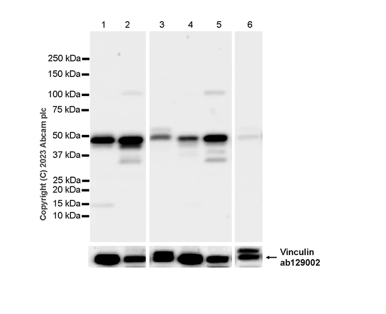 Western blot - Anti-MKK7 antibody [EP1455Y] - BSA and Azide free (AB239843)