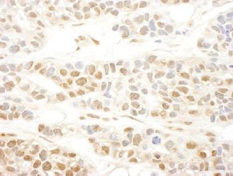 Immunohistochemistry (Formalin/PFA-fixed paraffin-embedded sections) - Anti-Mkl1/MRTFA antibody (AB113264)