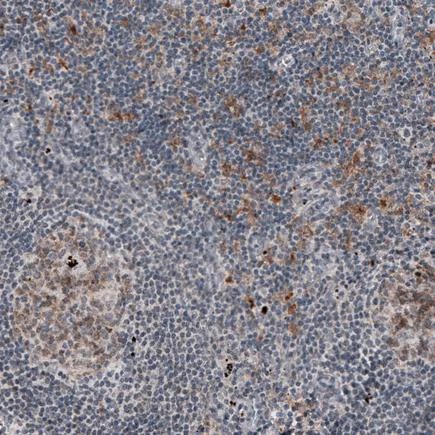 Immunohistochemistry (Formalin/PFA-fixed paraffin-embedded sections) - Anti-Mkl1/MRTFA antibody [CL4281] (AB219981)